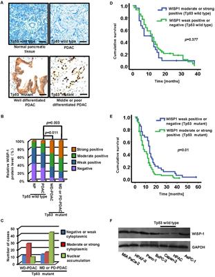 Tp53 Mutation Inhibits Ubiquitination and Degradation of WISP1 via Down-Regulation of Siah1 in Pancreatic Carcinogenesis